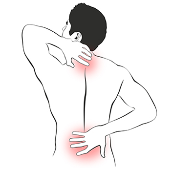 Darstellung eines schmerznden Rückens